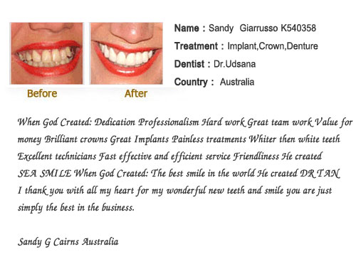 phuket smile dental