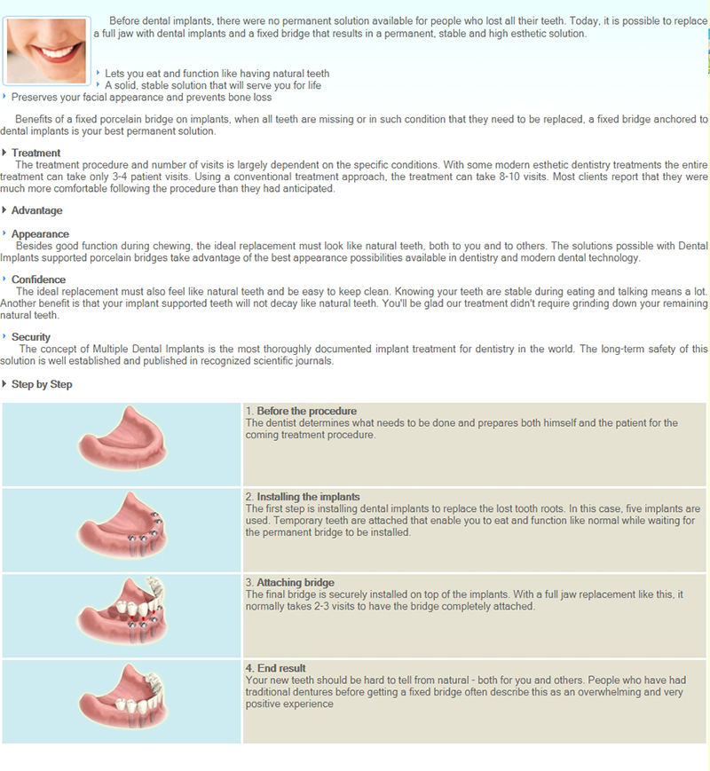 Dental Implants