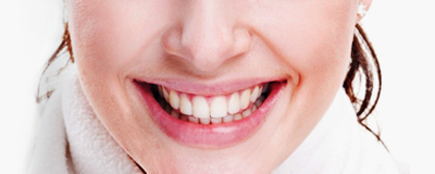 Laser tooth Whitening