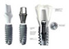 Dental Implant