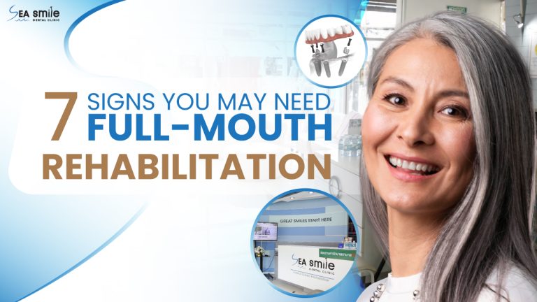 7 Signs You May Need Full Mouth Rehabilitation