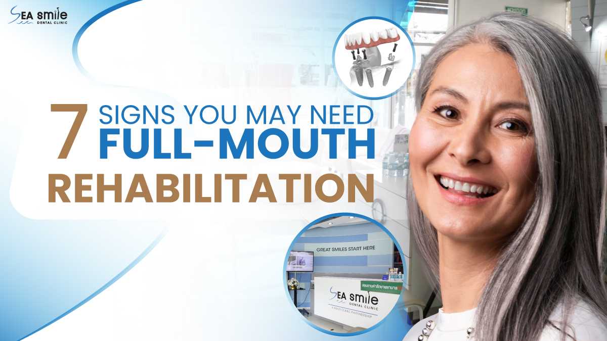 7 Signs You May Need Full Mouth Rehabilitation