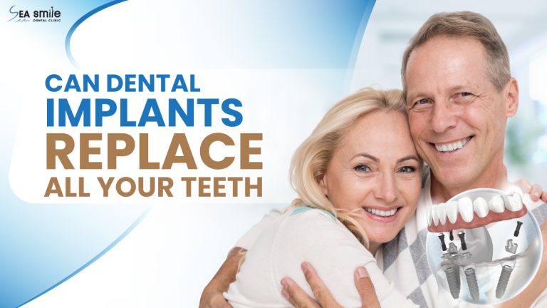 Can Dental Implants Replace All Your Teeth