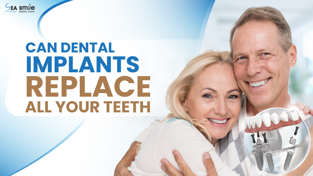 Can Dental Implants Replace All Your Teeth